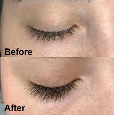 Forever Brow Eyebrow Growth Serum Before & After Pictures